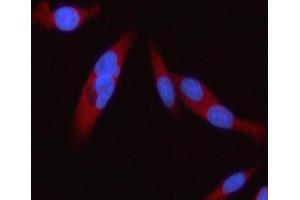 IF analysis of STAT2 using anti-STAT2 antibody (ABIN5692942).