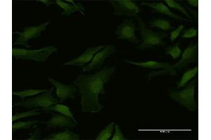 Immunofluorescence of purified MaxPab antibody to C9orf156 on HeLa cell.
