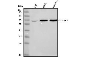 Western blot analysis of STXBP2 using anti-STXBP2 antibody (ABIN3043304).