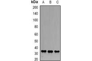 Western blot analysis of Emerin expression in Hela (A), Jurkat (B), PC3 (C) whole cell lysates. (Emerin anticorps)
