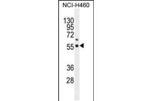 Western blot analysis in NCI-H460 cell line lysates (35ug/lane). (COQ6 anticorps  (N-Term))