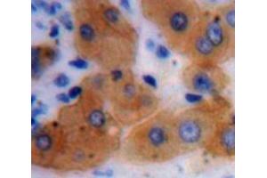 IHC-P analysis of Liver tissue, with DAB staining. (ADH1 anticorps  (AA 169-370))