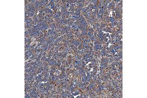 IHC analysis of SETD3 using anti-SETD3 antibody (ABIN7600293). (SETD3 anticorps  (AA 173-468))