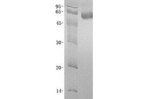 Validation with Western Blot (beta Arrestin 1 Protein (Transcript Variant 1) (His tag))