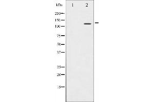 Western blot analysis of Integrin beta3 expression in NIH-3T3 whole cell lysates,The lane on the left is treated with the antigen-specific peptide. (Integrin beta 3 anticorps  (C-Term))