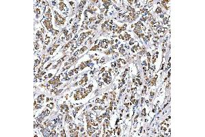 IHC analysis of SUCLG2 using anti-SUCLG2 antibody (ABIN7601694). (SUCLG2 anticorps  (AA 42-424))