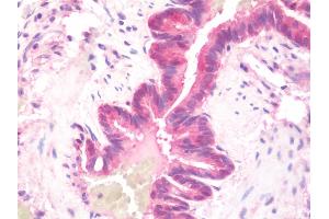 Anti-DNAJB6 / DnaJ antibody IHC staining of human lung.