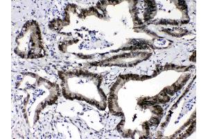 IHC analysis of Ran using anti-Ran antibody .