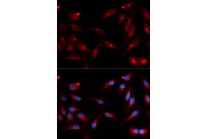 Immunofluorescence analysis of U2OS cells using ADAM9 antibody (ABIN5973121). (ADAM9 anticorps)