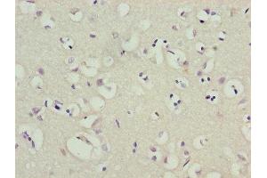 Immunohistochemistry of paraffin-embedded human brain tissue using ABIN7163973 at dilution of 1:100 (KCND1 anticorps  (AA 410-647))
