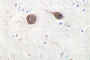 Image no. 1 for anti-C-Jun-Amino-Terminal Kinase-Interacting Protein 2 (JIP-2) antibody (ABIN272223) (IB2 anticorps)