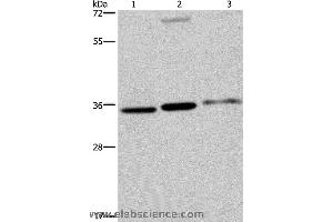 Western blot analysis of A375, 293T and SKOV3 cell, using PITX2 Polyclonal Antibody at dilution of 1:250 (PITX2 anticorps)