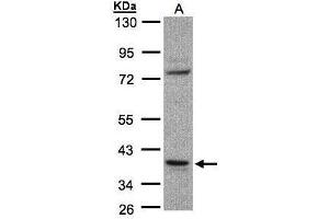 WB Image Sample(30 ug whole cell lysate) A:Raji , 10% SDS PAGE antibody diluted at 1:1000 (CCDC68 anticorps)