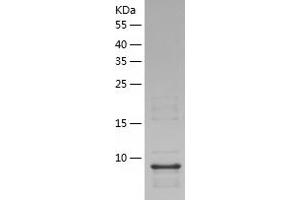 Western Blotting (WB) image for Chemokine (C-C Motif) Ligand 6 (CCL6) (AA 22-116) protein (His-IF2DI Tag) (ABIN7122376)