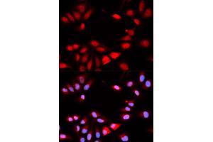 Immunofluorescence (IF) image for anti-Regulator of Calcineurin 1 (RCAN1) antibody (ABIN1876514) (RCAN1 anticorps)