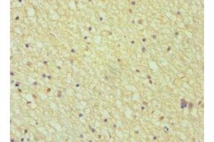 Immunohistochemistry of paraffin-embedded human brain tissue using ABIN7144027 at dilution of 1:100 (Amphiphysin anticorps  (AA 340-620))