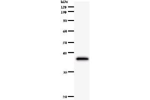 Western Blotting (WB) image for anti-Cbl Proto-Oncogene B, E3 Ubiquitin Protein Ligase (CBLB) antibody (ABIN933045) (Cbl Proto-Oncogene B, E3 Ubiquitin Protein Ligase (CBLB) anticorps)