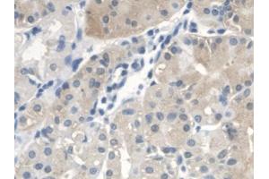 DAB staining on IHC-P; Samples: Human Stomach Tissue (CTBS anticorps  (AA 47-385))
