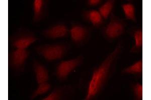 Immunofluorescence staining of methanol-fixed Hela cells using using Phospho-GATA1-S310 antibody. (GATA1 anticorps  (pSer310))