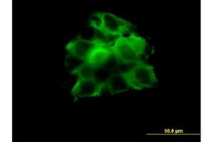 Immunofluorescence of monoclonal antibody to CCT2 on A-431 cell. (CCT2 anticorps  (AA 117-217))