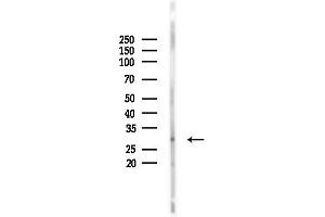 anti-Carbonic Anhydrase VII (CA7) (C-Term) antibody