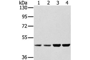 Western Blot analysis of Hela, Raji, 231 and K562 cell using SSB Polyclonal Antibody at dilution of 1:400 (SSB anticorps)