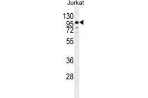 ZNF841 Antibody (N-term) western blot analysis in Jurkat cell line lysates (35 µg/lane).
