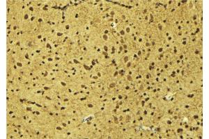 ABIN6275194 at 1/100 staining Mouse brain tissue by IHC-P. (Msx2/Hox8 anticorps  (Internal Region))