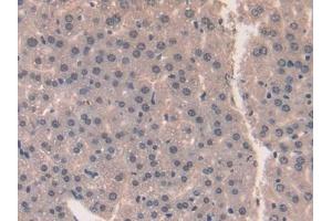 Used in DAB staining on fromalin fixed paraffin- embedded liver tissue (Midkine anticorps  (AA 22-140))