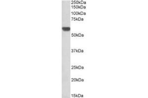 Image no. 1 for anti-Glucose-6-Phosphate Isomerase (GPI) (AA 81-93), (Internal Region) antibody (ABIN487978) (GPI anticorps  (Internal Region))