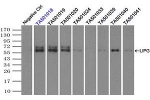Image no. 8 for anti-Lipase, Endothelial (LIPG) antibody (ABIN1499165) (LIPG anticorps)