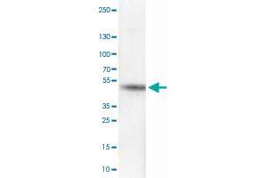 Western Blot analysis of RT-4 cell lysate with CA12 monoclonal antibody, clone CL0280 . (CA12 anticorps)