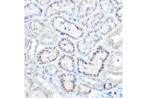 Immunohistochemistry of paraffin-embedded rat kidney using TIMP2 Rabbit pAb (ABIN3022132, ABIN3022133, ABIN1513608, ABIN1514751 and ABIN6218618) at dilution of 1:100 (40x lens). (TIMP2 anticorps  (AA 100-200))
