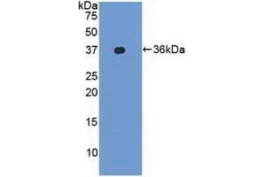 Detection of Recombinant LFA1a, Human using Polyclonal Antibody to Lymphocyte Function Associated Antigen 1 Alpha (CD11a)