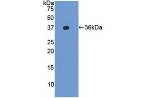 Detection of Recombinant LFA1a, Human using Polyclonal Antibody to Lymphocyte Function Associated Antigen 1 Alpha (CD11a) (ITGAL anticorps  (AA 809-1066))