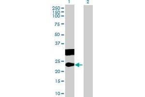 Western Blot analysis of CT45A3 expression in transfected 293T cell line by CT45A3 MaxPab polyclonal antibody. (CT45A3 anticorps  (AA 1-189))