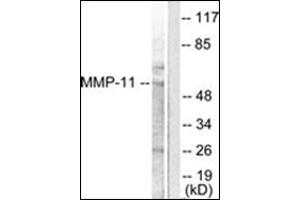 Western blot analysis of extracts from A549 cells, using MMP-11 Antibody. (MMP11 anticorps  (Internal Region))