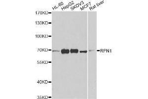 Western blot analysis of extracts of various cell lines, using RPN1 antibody. (RPN1 anticorps  (AA 20-280))