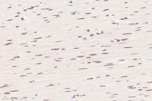 Immunohistochemistry analysis of paraffin-embedded rat heart using,RBM10 (ABIN7075473) at dilution of 1: 6000 (RBM10 anticorps)