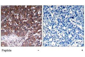 Image no. 1 for anti-Insulin-Like Growth Factor 1 Receptor (IGF1R) (Tyr1280) antibody (ABIN197576)