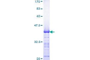Image no. 1 for Transcription Factor AP-2 beta (Activating Enhancer Binding Protein 2 Beta) (TFAP2B) (AA 73-182) protein (GST tag) (ABIN1322527) (TFAP2B Protein (AA 73-182) (GST tag))