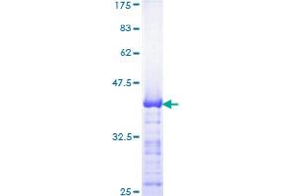 TFAP2B Protein (AA 73-182) (GST tag)