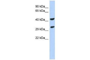 Western Blotting (WB) image for anti-Ankyrin Repeat and SOCS Box Containing 8 (ASB8) (N-Term) antibody (ABIN634410) (ASB8 anticorps  (N-Term))