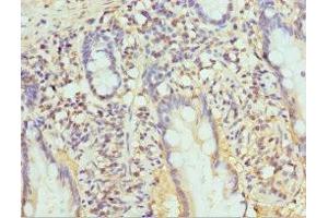 Immunohistochemistry of paraffin-embedded human small intestine tissue using ABIN7164972 at dilution of 1:100 (PSMB1 anticorps  (AA 1-273))