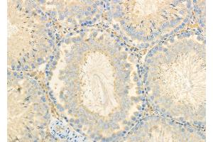 ABIN6260742 and ABIN6278109 at 1/100 staining Rat testis tissue by IHC-P.