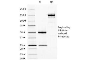 SDS-PAGE Analysis of Purified, BSA-Free Fascin Antibody (clone FSCN1/417). (Fascin anticorps)