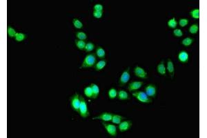 Immunofluorescent analysis of PC-3 cells using ABIN7158230 at dilution of 1:100 and Alexa Fluor 488-congugated AffiniPure Goat Anti-Rabbit IgG(H+L) (DLEU1 anticorps  (AA 1-78))