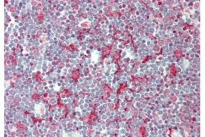 Rabbit Anti-SMPD3 antibody  Formalin Fixed Paraffin Embedded Tissue: Human Thymus Primary antibody Concentration: 1:100 Secondary Antibody: Donkey anti-Rabbit-Cy3 Secondary Antibody Concentration: 1:200 Magnification: 20x Exposure Time: 0.