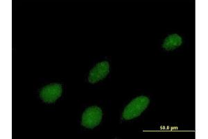 Immunofluorescence of purified MaxPab antibody to IPMK on HeLa cell.