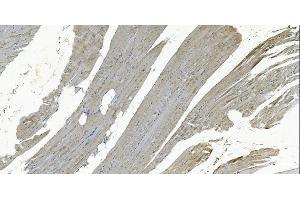 IHC analysis of GSTA4 using anti-GSTA4 antibody (ABIN7601113).